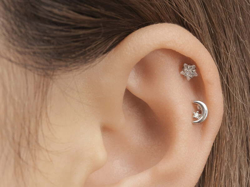 Triệu chứng của dị ứng khi đeo khuyên tai